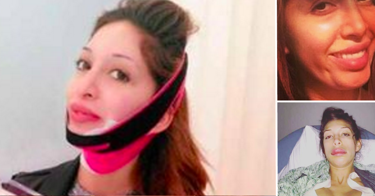 Farrah Abraham’s Plastic Surgery Evolution